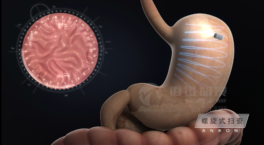 醫(yī)學(xué)醫(yī)療三維動(dòng)畫(huà)