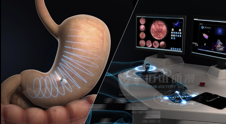 醫(yī)學(xué)醫(yī)療三維動(dòng)畫(huà)