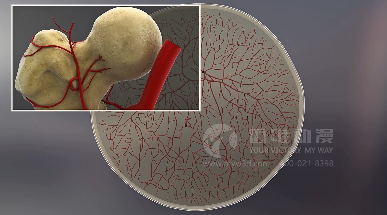 醫(yī)學醫(yī)療三維動畫 醫(yī)學醫(yī)療三維動畫