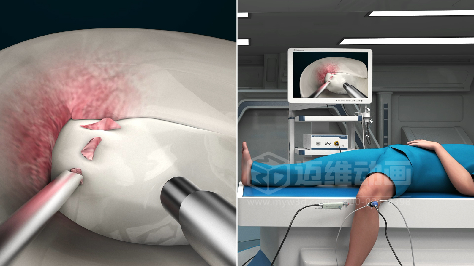 三維動畫制作在展現(xiàn)醫(yī)療器械方面能給企業(yè)帶來諸多優(yōu)勢，這5點不容忽視！(圖3)