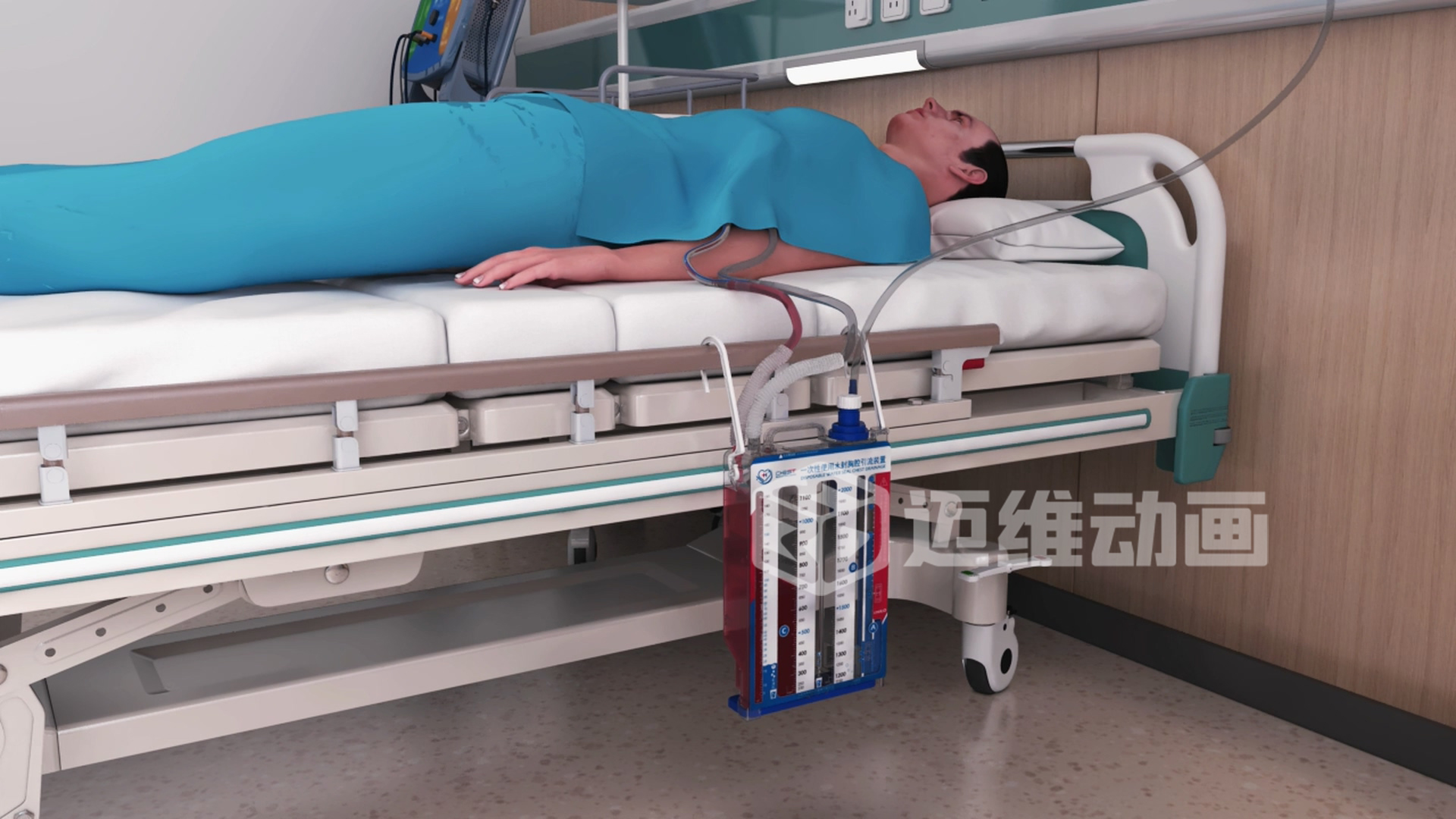 水封胸腔引流裝置三維動(dòng)畫(huà) 水封胸腔引流裝置三維動(dòng)畫(huà)