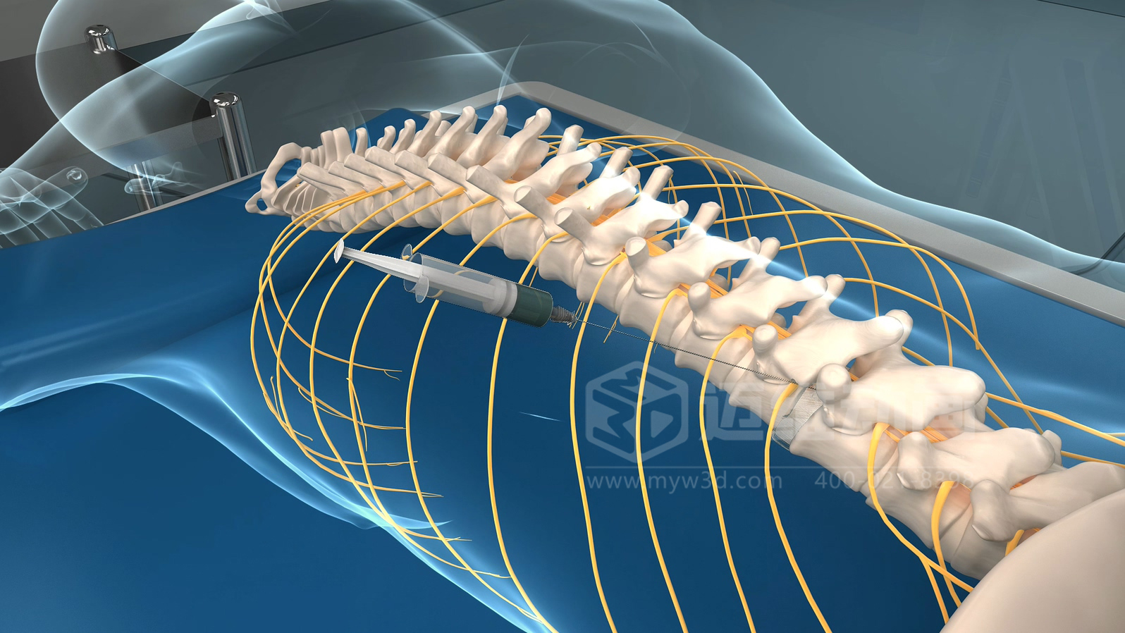 從實(shí)驗(yàn)室到手術(shù)室：邁維動(dòng)漫用三維動(dòng)畫，讓精密科技“看得見，懂得到”訂單轉(zhuǎn)化率提高 50%(圖6)