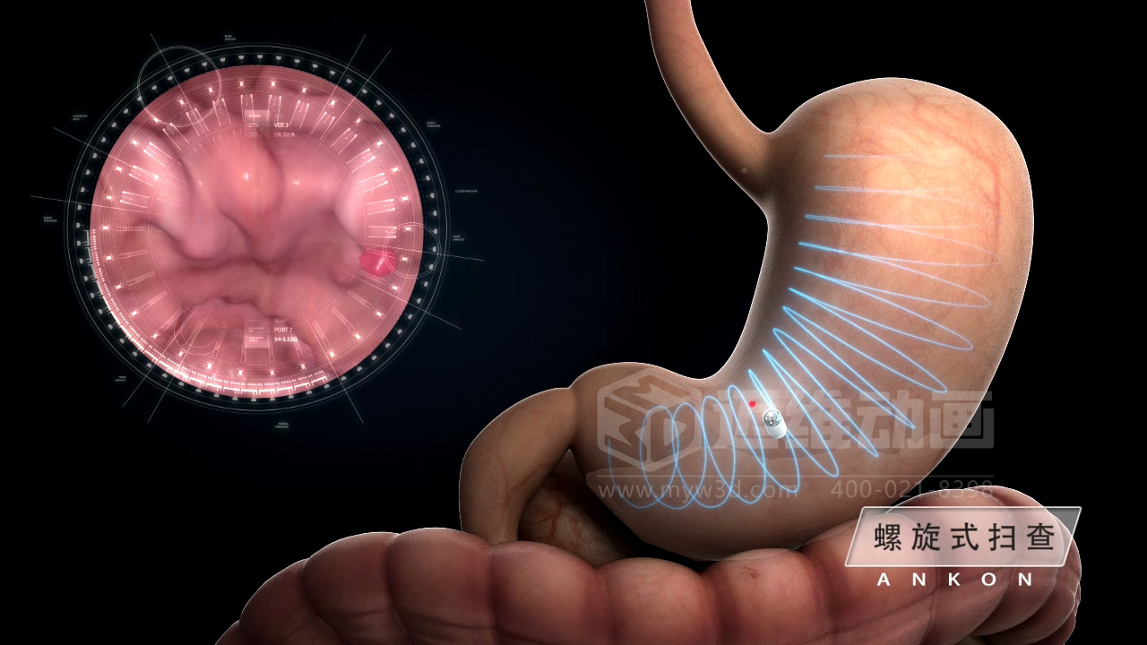 從實(shí)驗(yàn)室到手術(shù)室：邁維動(dòng)漫用三維動(dòng)畫，讓精密科技“看得見，懂得到”訂單轉(zhuǎn)化率提高 50%(圖3)