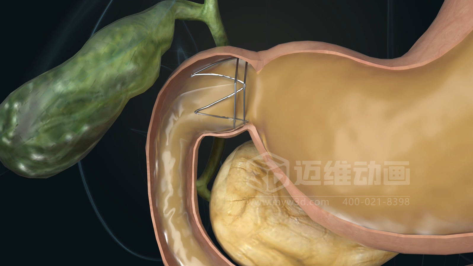 從實(shí)驗(yàn)室到手術(shù)室：邁維動(dòng)漫用三維動(dòng)畫，讓精密科技“看得見，懂得到”訂單轉(zhuǎn)化率提高 50%(圖11)